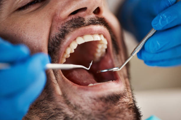 Best Emergency Tooth Extraction in Celebration, FL